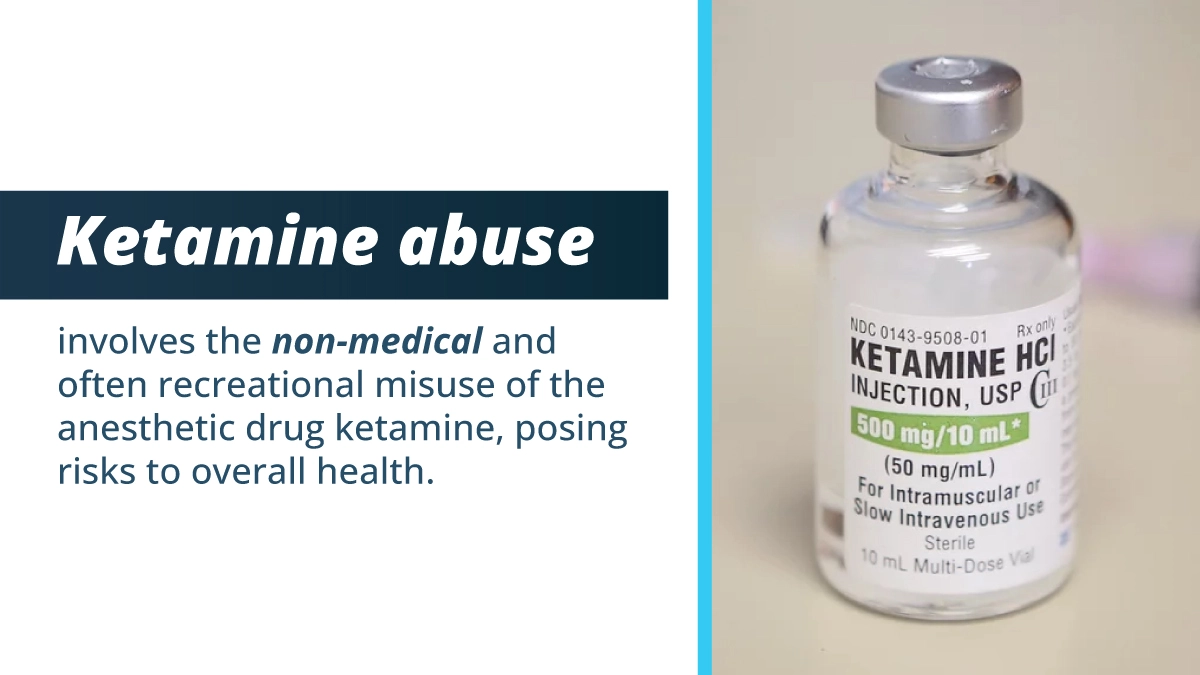 Vial labeled “Ketamine.” Ketamine abuse involves the non-medical and recreational misuse of the anesthetic drug ketamine.