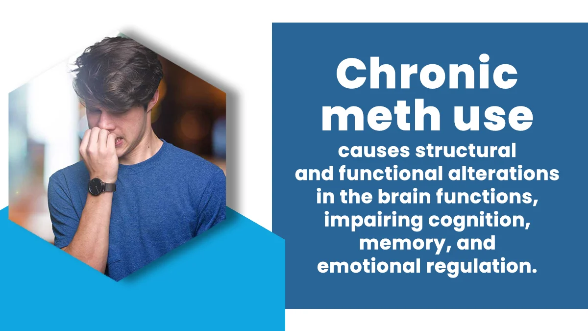 Man in a blue shirt biting his nails. Text: Chronic meth use causes structural and functional alterations in the brain.
